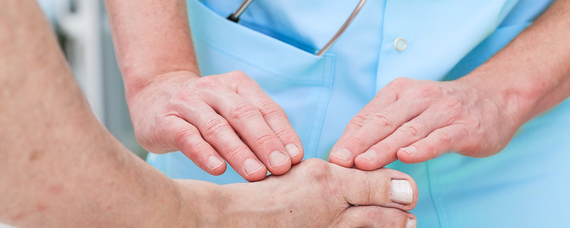 Jak wygląda rehabilitacja po operacji haluksa